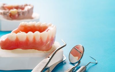 Dantų protezavimas – tiltelis ar implantai?